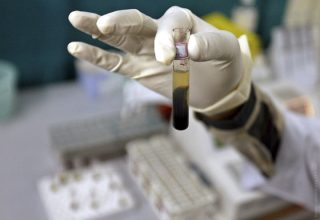 Вакцина против ВИЧ сработала на людях